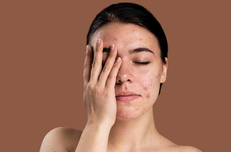 cân bằng và phục hồi da nhạy cảm